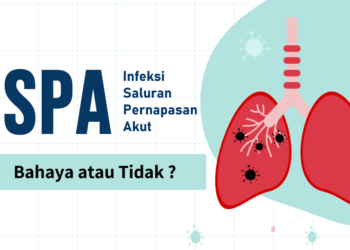 Hingga Juli 2024, Puluhan Ribu Warga Kota Sukabumi Terjangkit ISPA