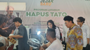 Dana Zakat untuk Pemberdayaan, BAZNAS Jabar Fasilitasi Hapus Tato Gratis